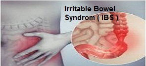 Irritable Bowel Syndrome.jpg