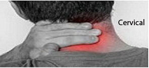 Cervical Pain